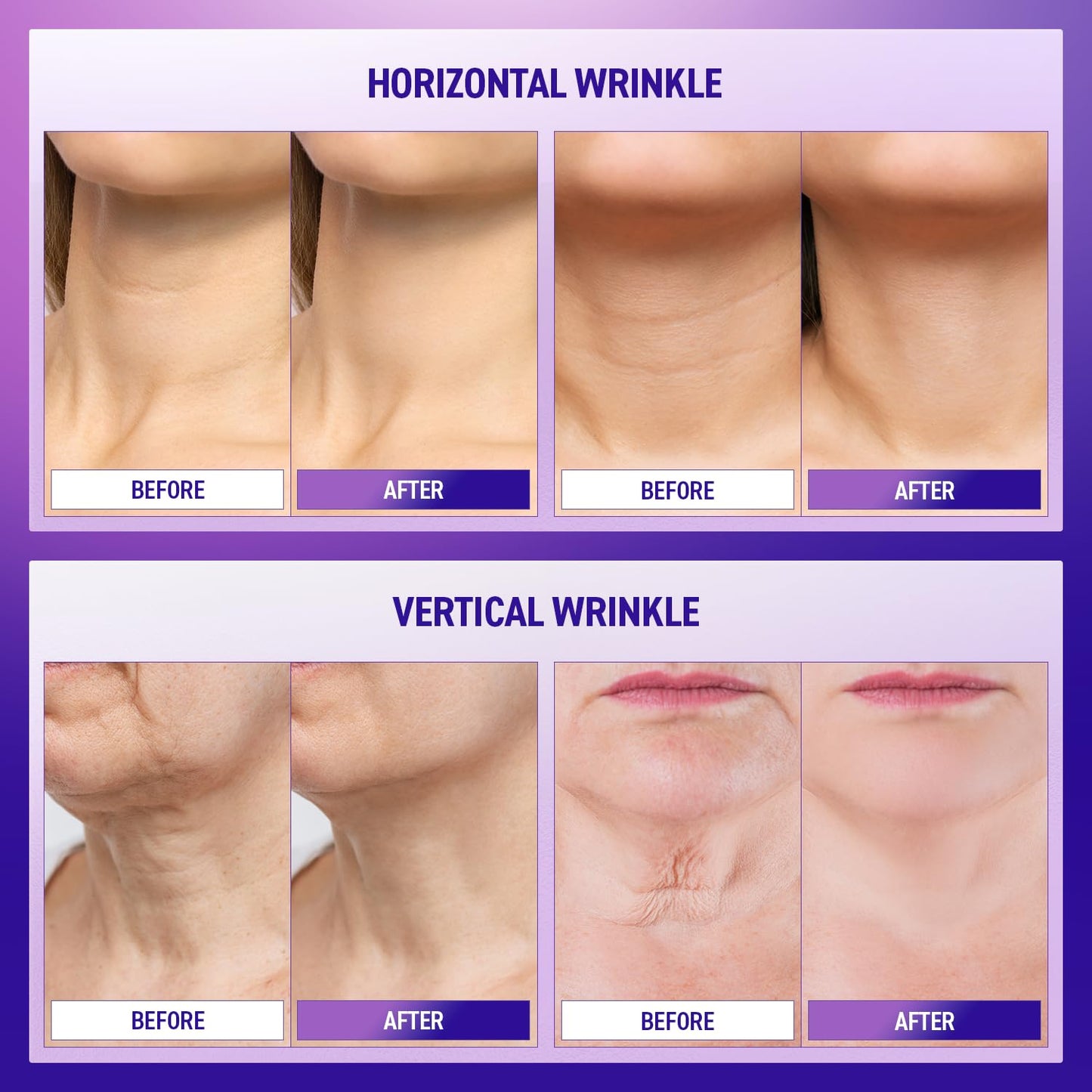 Neck Firming Cream : Skin Tightening Cream Moisturizer Face and Neck Lift Tightening with Hyaluronic Acid & Peptide & Adenosine Korean Skin Care & Advanced Formula 1.7 fl oz